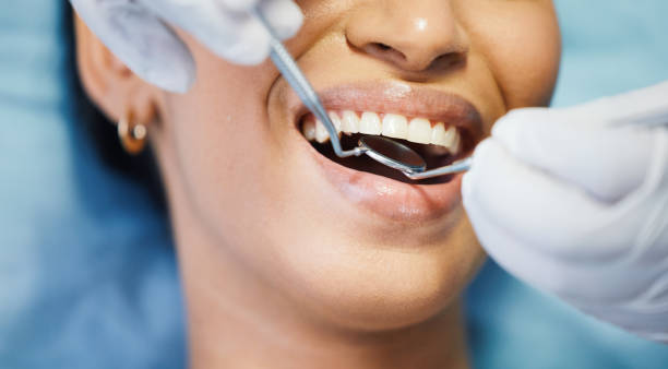Best 24-Hour Emergency Dentist in Mckinleyville, CA